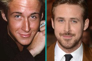 Breaking Down Stereotypes About Male Rhinoplasty
