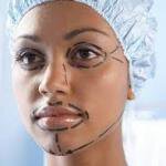 ethnic-girl-with-plastic-surgery-pen-marks
