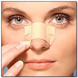 What is Revision Rhinoplasty?