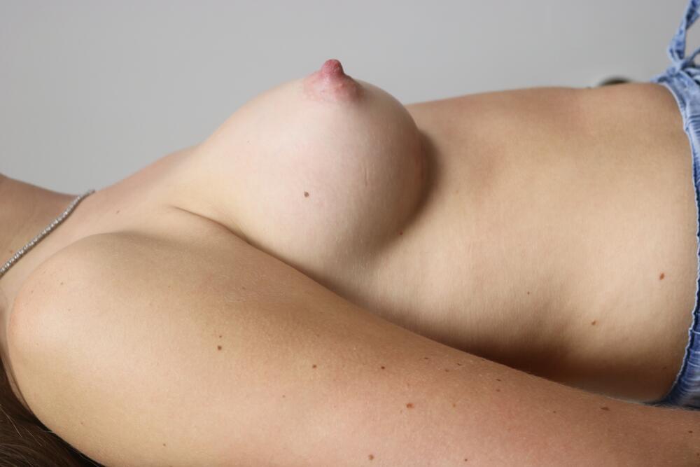 Breast Augmentation Before & After