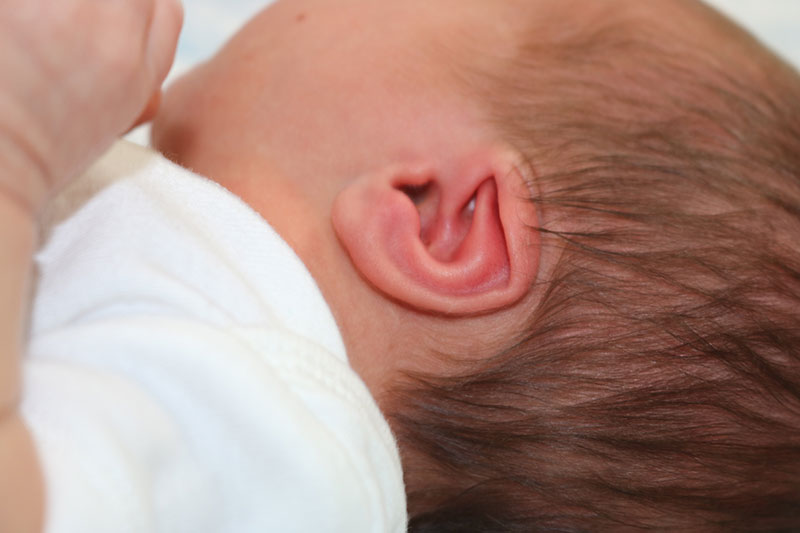 Ear Molding Before & After Image